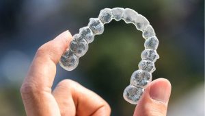 invisalign-dentist-in-airdrie