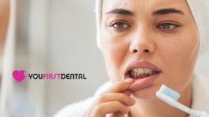 bleeding-gums-airdrie-dentist