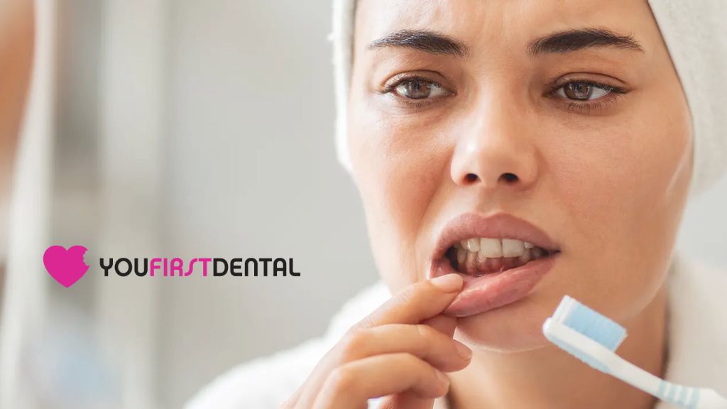 bleeding-gums-airdrie-dentist