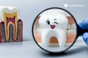 dental-hygiene-dentist-airdrie-alberta